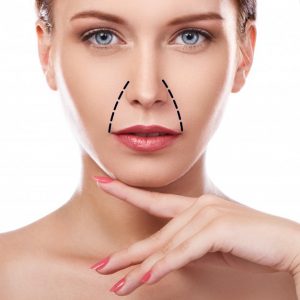 bruzdy-nosowo-wargowe