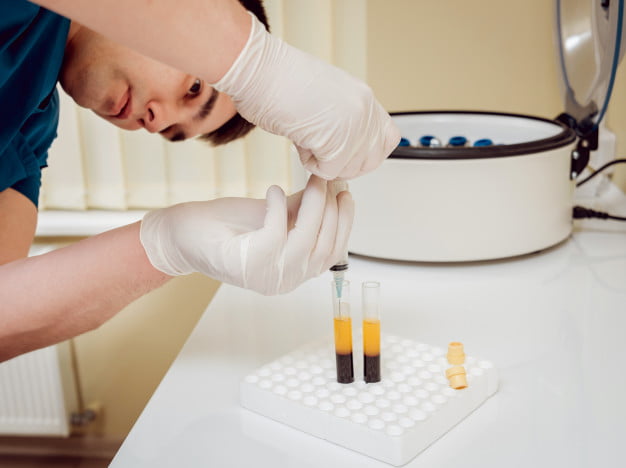 Wampirzy lifting czyli osocze bogatopłytkowe 2 Wampirzy lifting