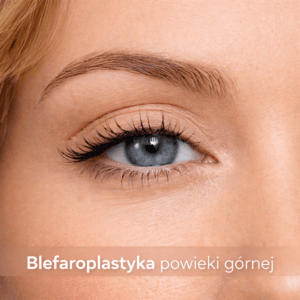 Plastyka powiek górnych