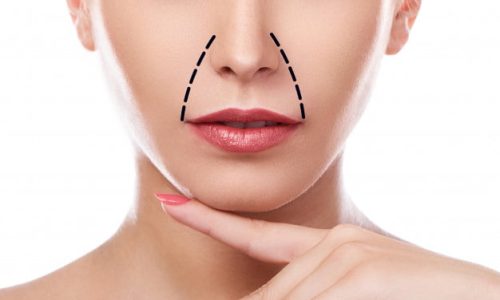 bruzdy-nosowo-wargowe