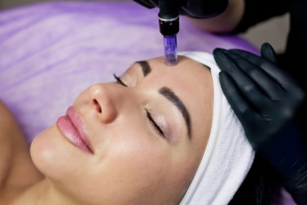 Dermapen 3 Dermapen czoło